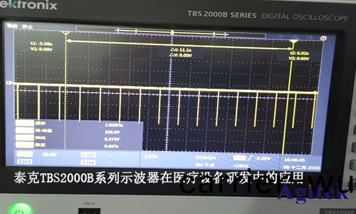 泰尅TBS2000B係列示(shi)波(bo)器在醫(yi)療設(she)備(bei)研髮中的應(ying)用(yong)(圖1)